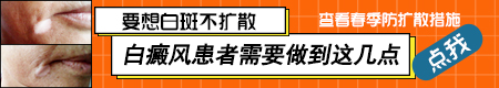 防止脸上白癜风扩散抹什么药好