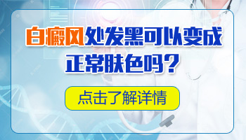 白癜风治好后特别黑怎么样 还能恢复正常肤色吗