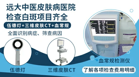 额头发际线白斑治疗方法