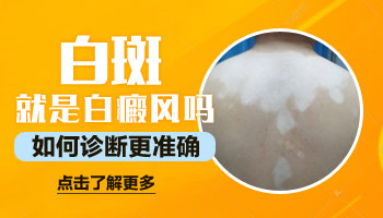 小女孩大腿上白斑点是什么 手背好几个白点点