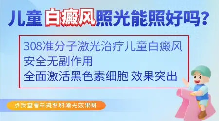 儿童白癜风照光能治好吗