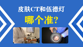 宝宝大腿内部有一块光滑的白斑