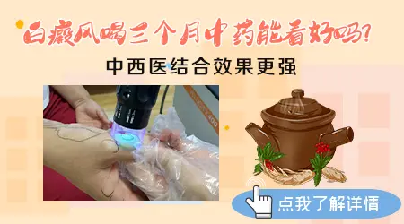 白癜风患者喝中药管用吗