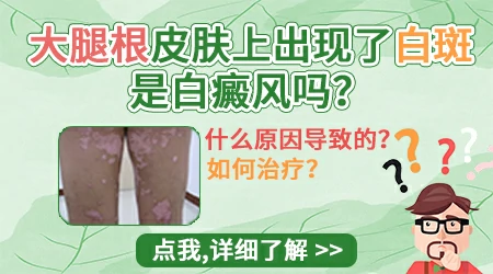 大腿根内侧出现白色斑块