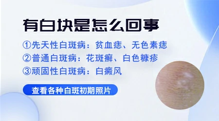 皮肤局部变白怎么回事