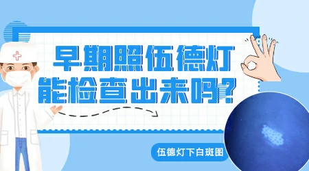 伍德灯下照着皮肤发白是什么情况