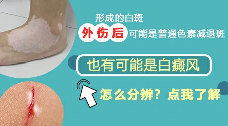 腿受伤好了以后皮肤发白