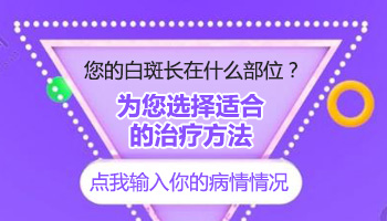 白癜风始发于身体的什么位置