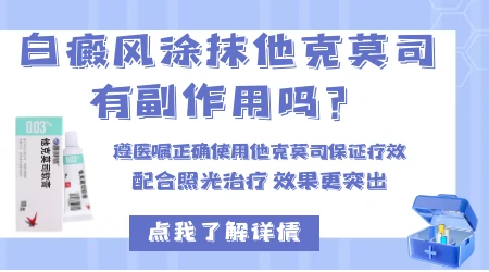 白斑抹他克莫司一个月没效果