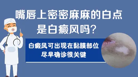 嘴唇白癜风早期的图片