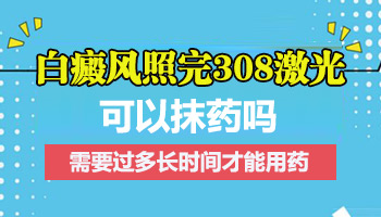 白癜风患者照射308后需要抹药膏吗