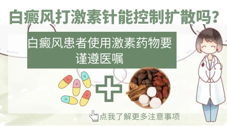 白癜风面积好像比原来大了一点