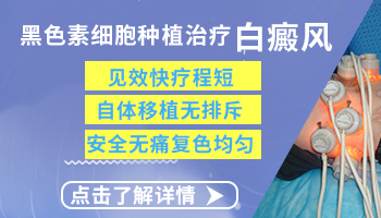 白癜风好几年了面积不大怎么回事