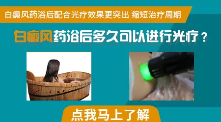 药浴可以治白癜风吗