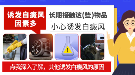 内蒙古引发白癜风都跟哪些因素有关 内蒙古白癜风医院