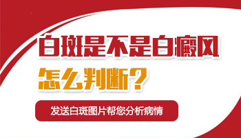 和婴儿白癜风比较相似的几种皮肤病有哪些