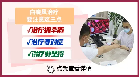 白癜风照311白斑会扩散吗