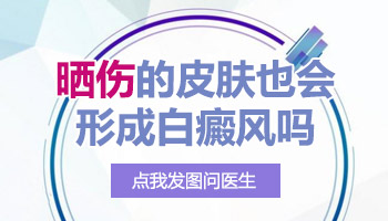 晒太阳后脸上有白斑怎么办