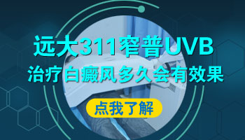 窄谱uvb紫外线治疗白斑价格