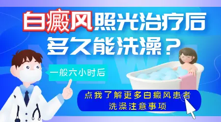 白癜风照了308多长时间可以洗澡