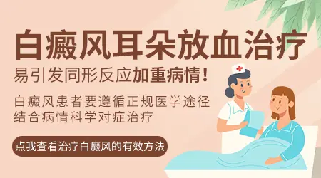 耳朵扎针放血能治疗白癜风吗