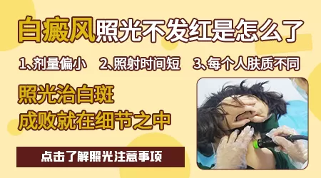 隐形白斑照不红吗