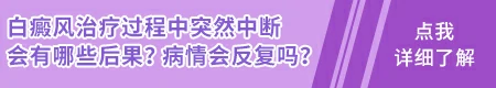 白癜风可以报考部队文职吗