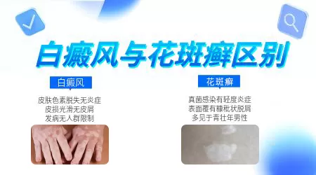 汗斑和白癜风对比图