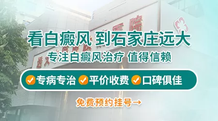 伍德氏灯下检查白斑无荧光反应