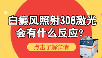 照308长了新白斑是不是刺激到白癜风了