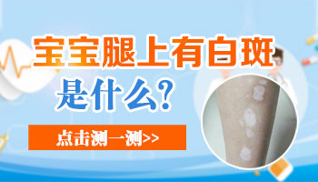 宝宝大腿内侧有块白斑