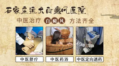 白癜风中医治疗的方法有哪些