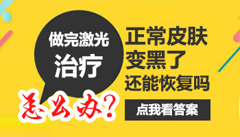 308激光照黑了正常的皮肤后能恢复正常颜色吗