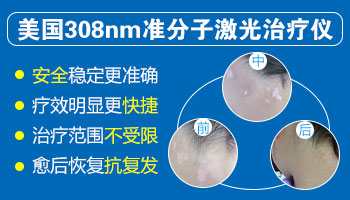 一台美国极速308准分子治疗仪多少钱