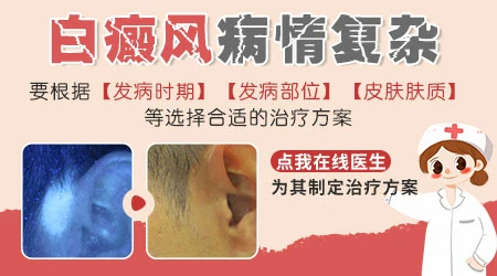 男大腿根白斑怎么办