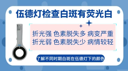 白斑照伍德灯显示荧白色是什么情况