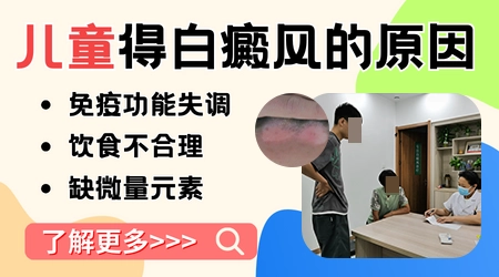 怎么识别小孩白癜风