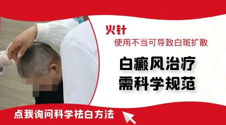 火针治白斑恢复过程图