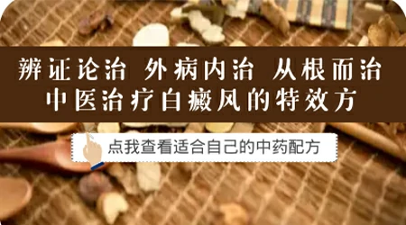 远大医院治白癜风费用贵吗