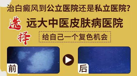 儿童白癜风病初期白点