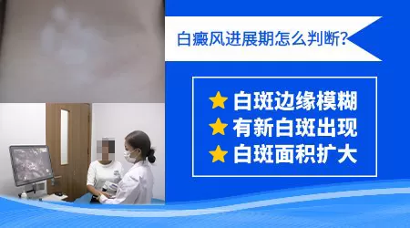 白癜风扩散到后背怎么治