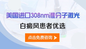 进口308激光能不能治好白癜风