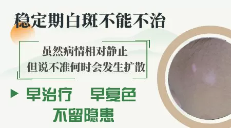 稳定的白癜风用哪种方法治疗效果好