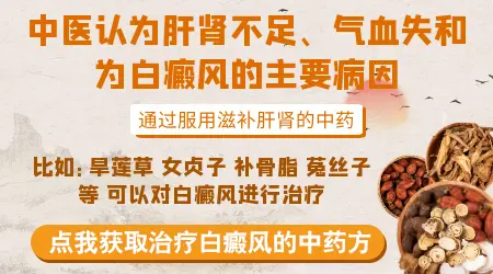 治疗白癜风一般服中药多长时间见效