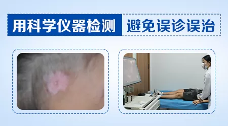 孩子腿上有一小点不规则白斑