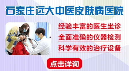 308激光照射白斑后脱皮了是不是要扩散