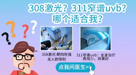 白癜风用308治疗好还是311治疗好