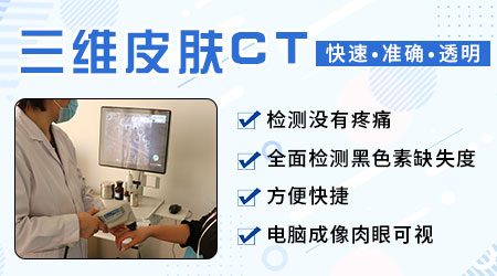 检查白斑要做哪些检查