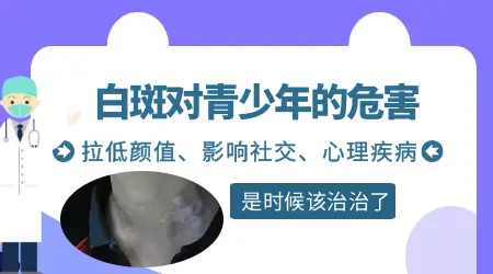 青少年白癜风治疗周期长吗