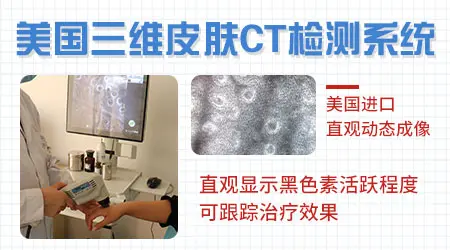 河北省哪些医院有三维皮肤ct